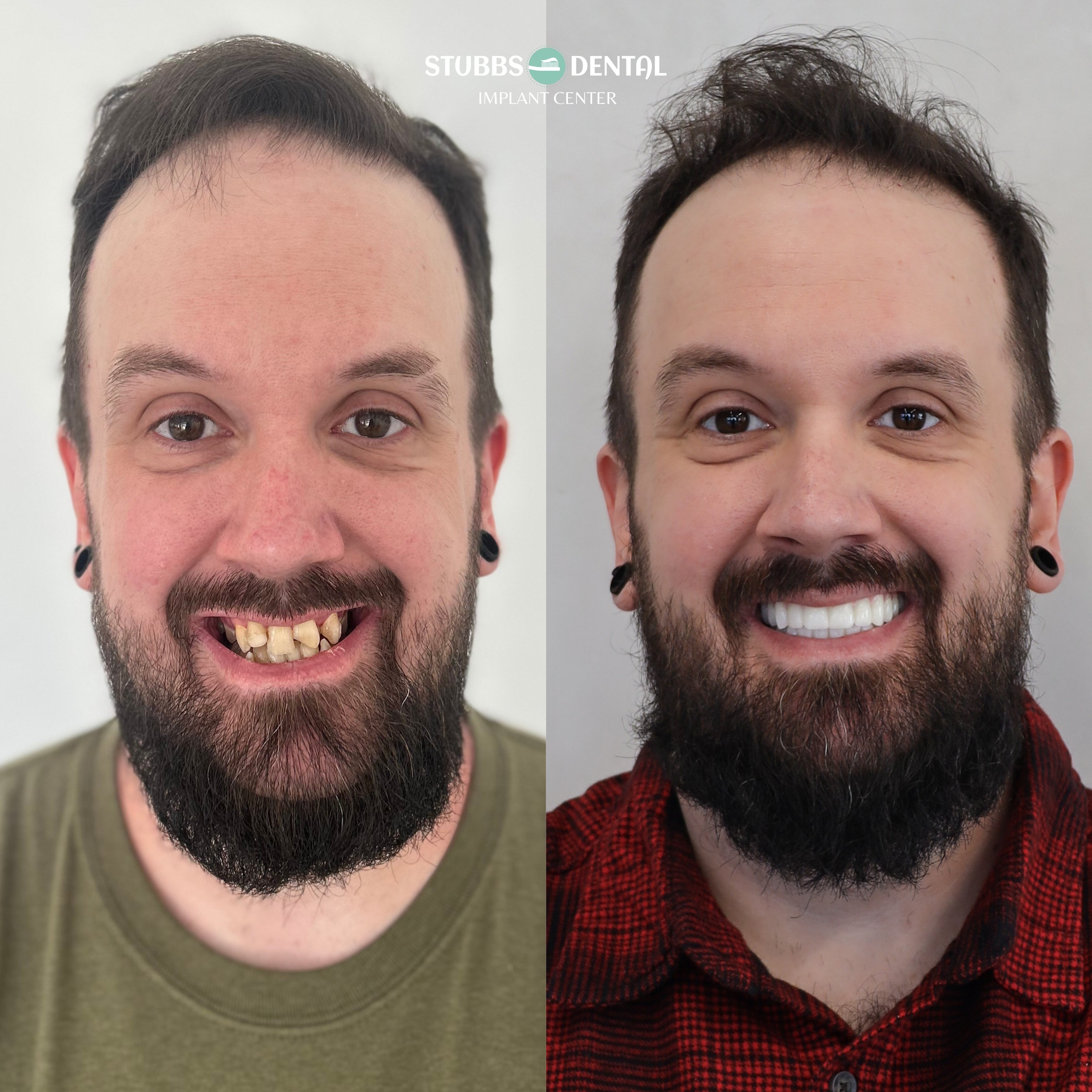 Brandon Boyles - Before & After (Finals)