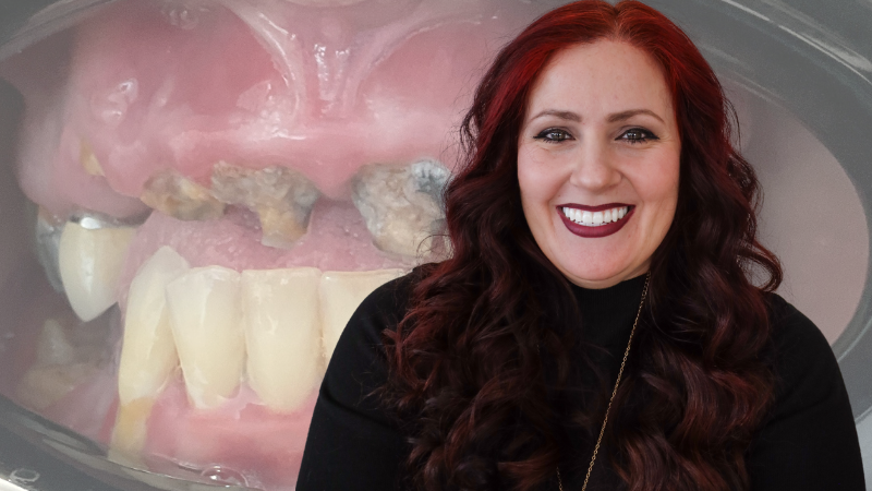 Stubbs Dental full mouth dental implants