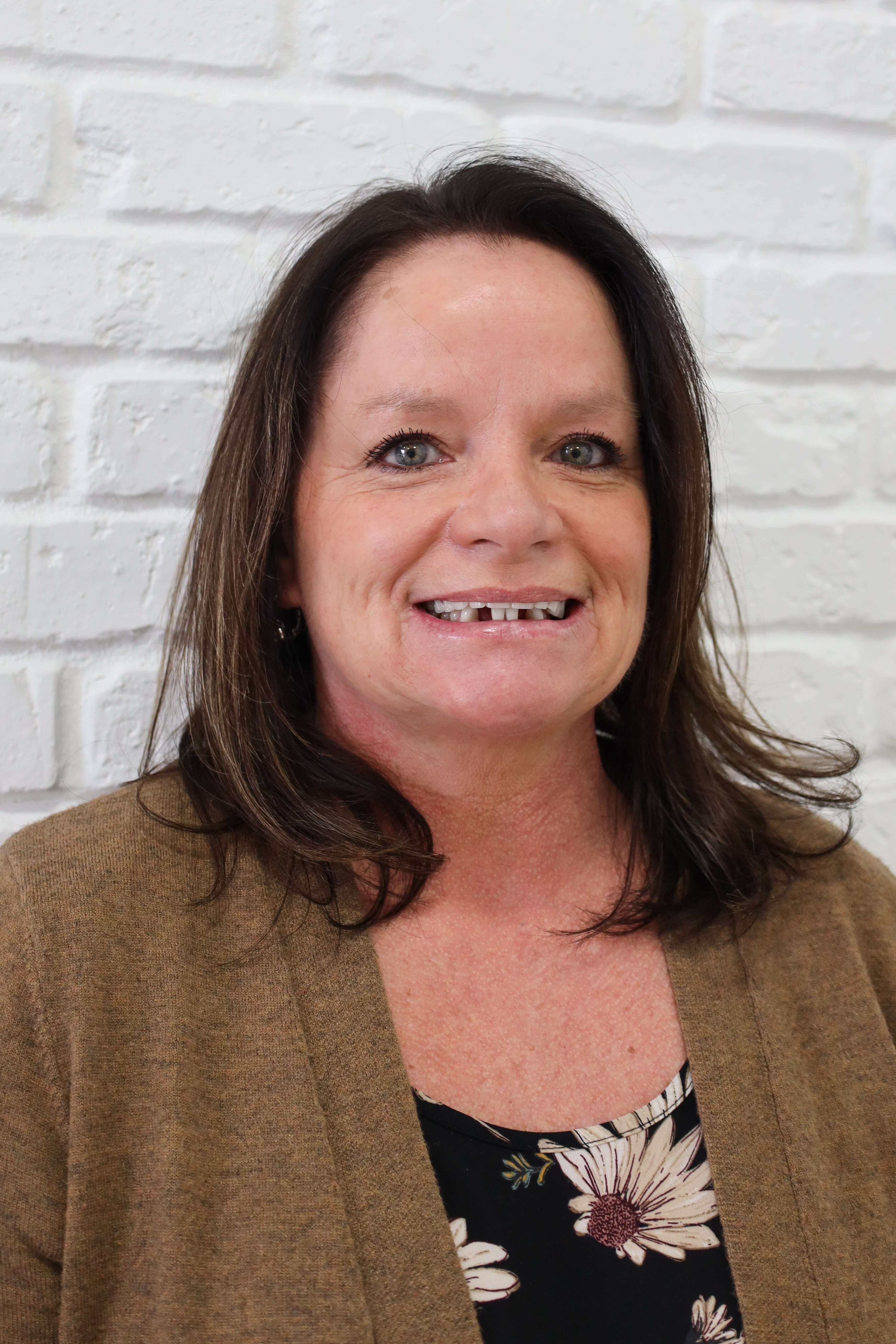 missing teeth before dental implants