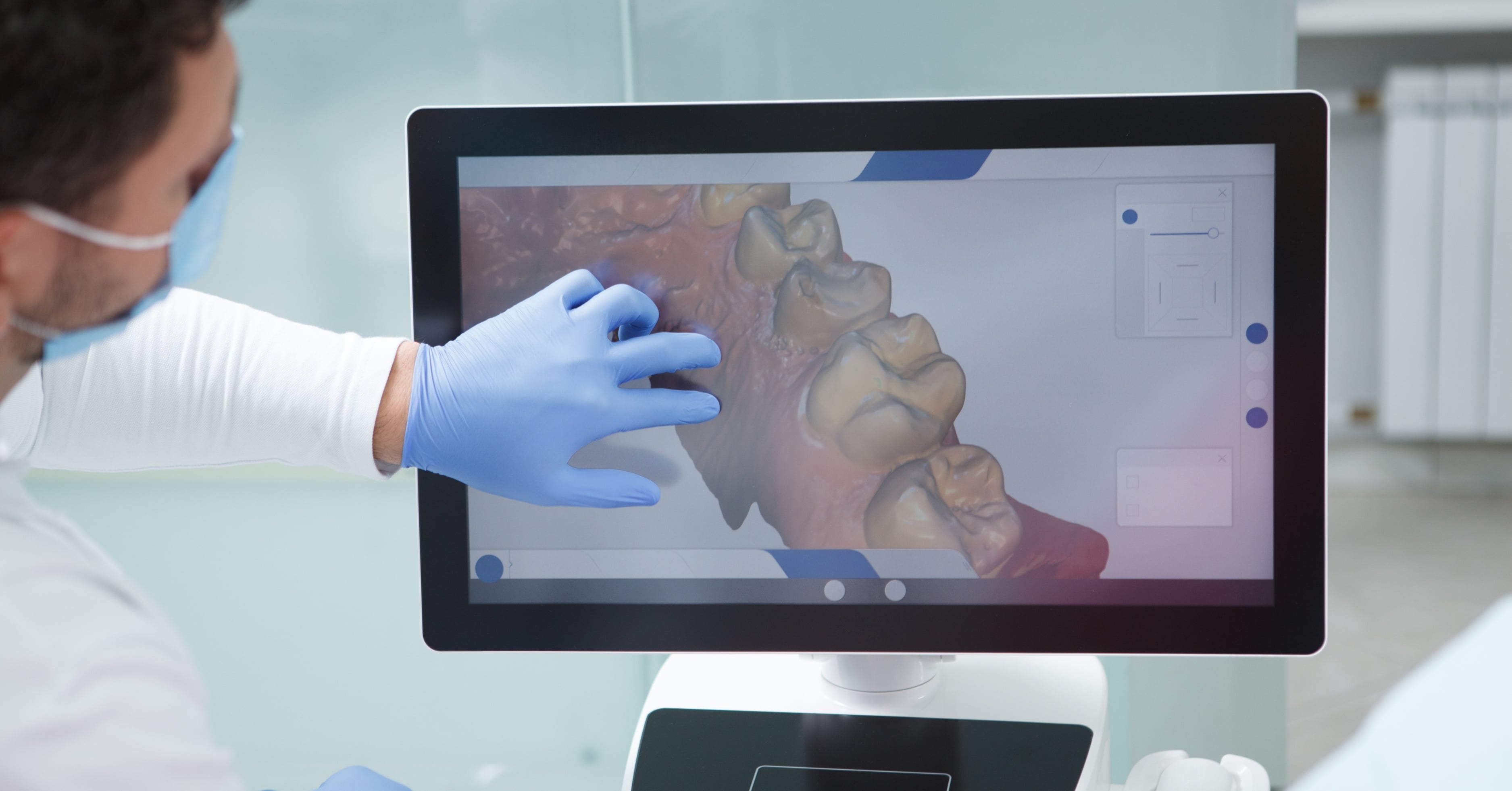 Ribbond and Bio-Core at Stubbs Dental Implant Center