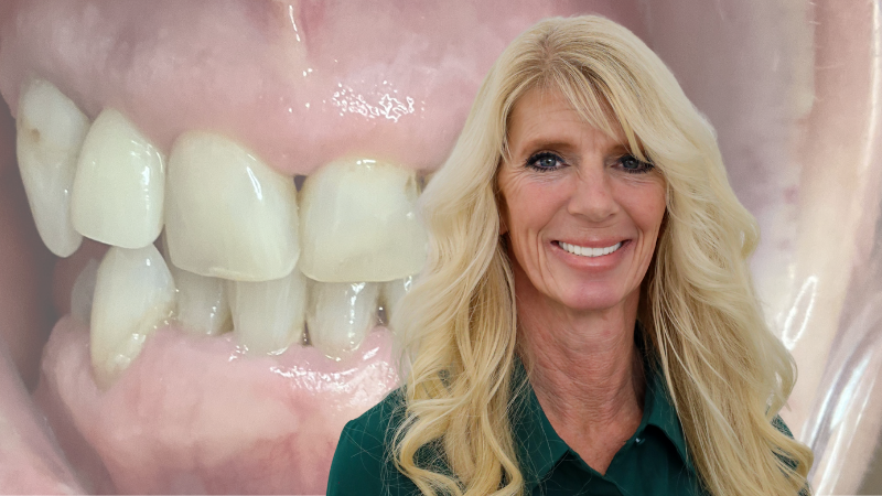 dental implants utah