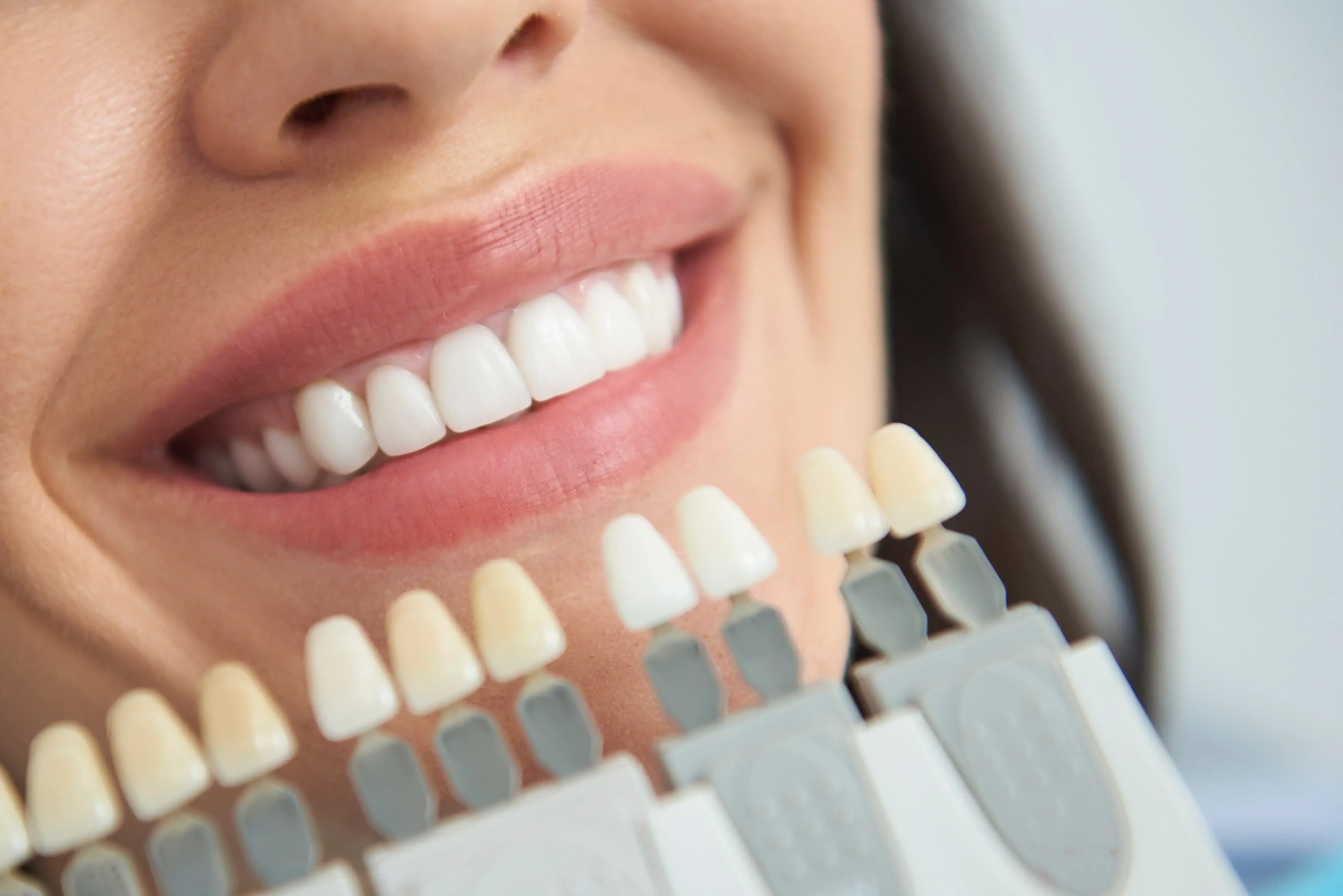 patient comparing teeth whitening shades utah