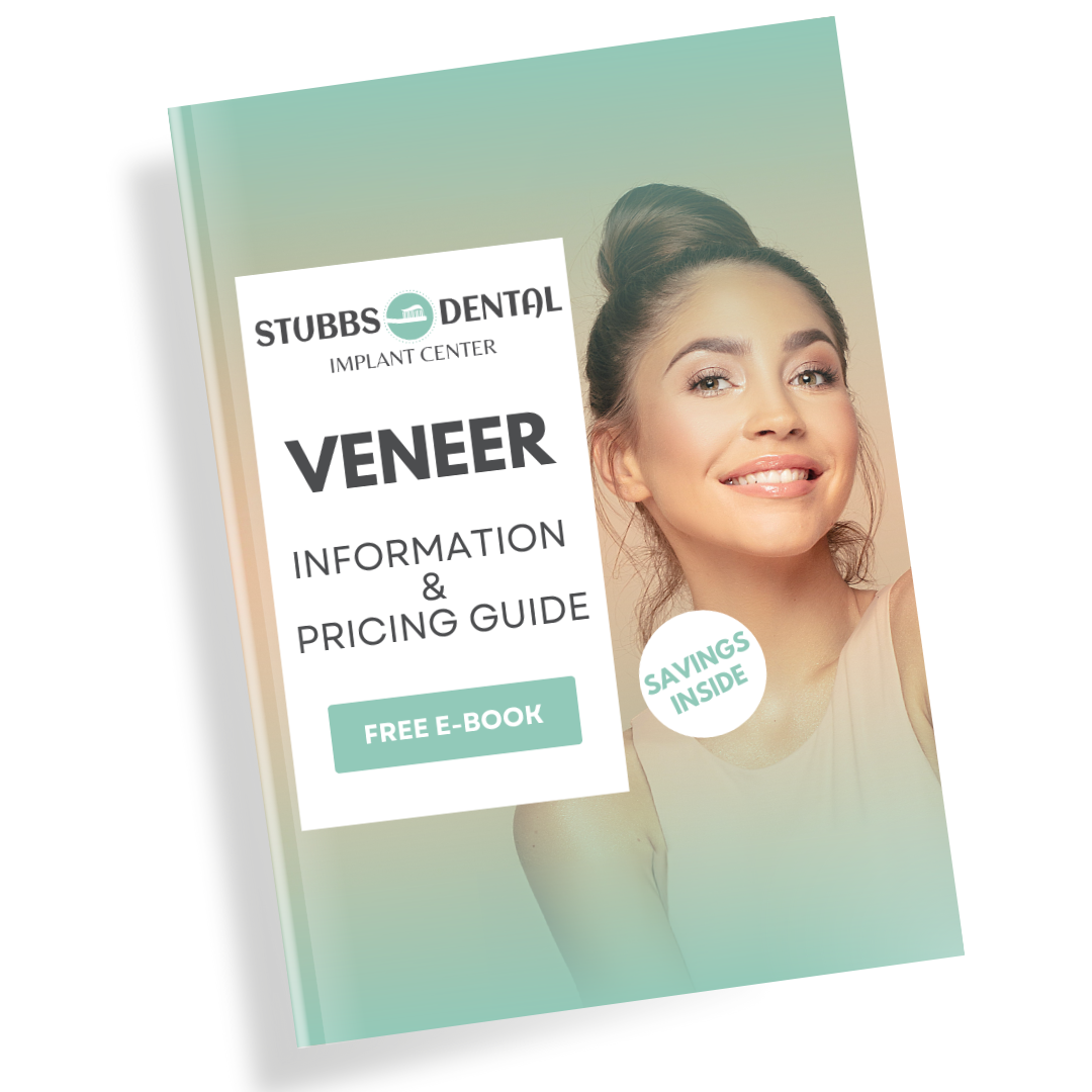 EBook Veneer Pricing Guide Cover Image (1)