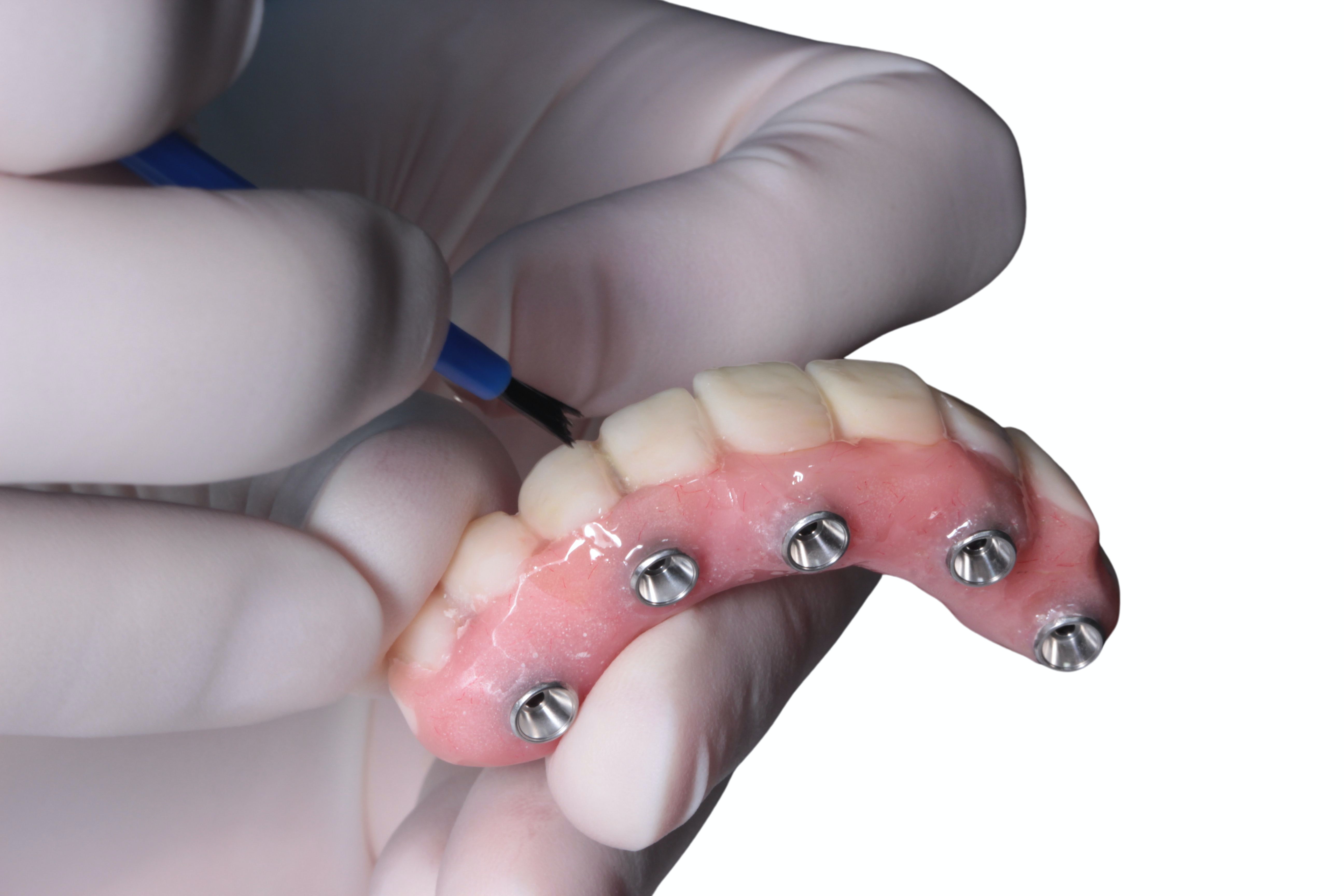 Implant Supported Dentures Stubbs Dental Implant Center