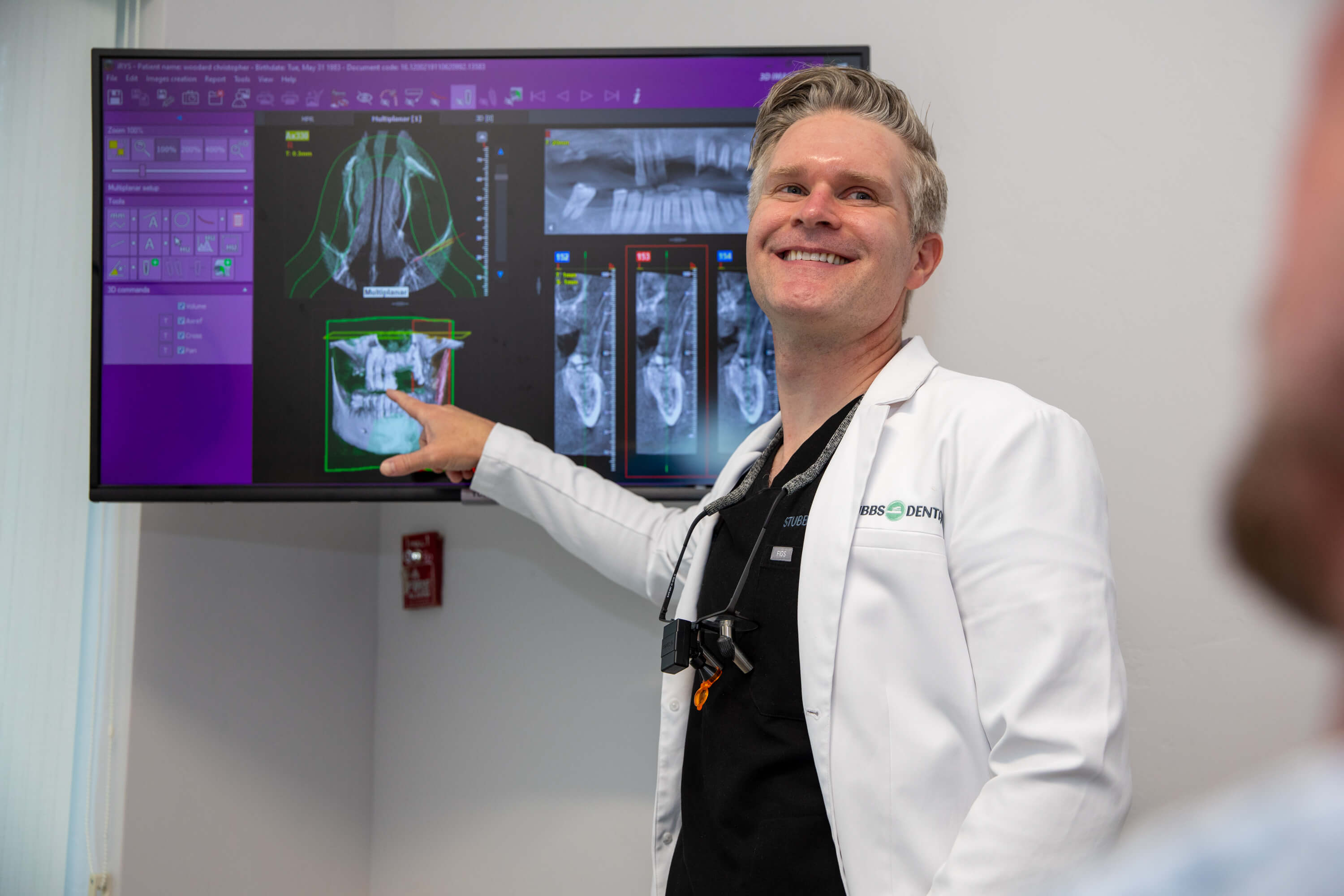 CBCT 3D digital dentistry technology at Stubbs Dental