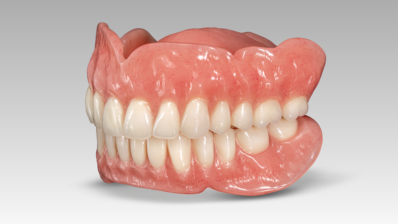 Traditional dentures