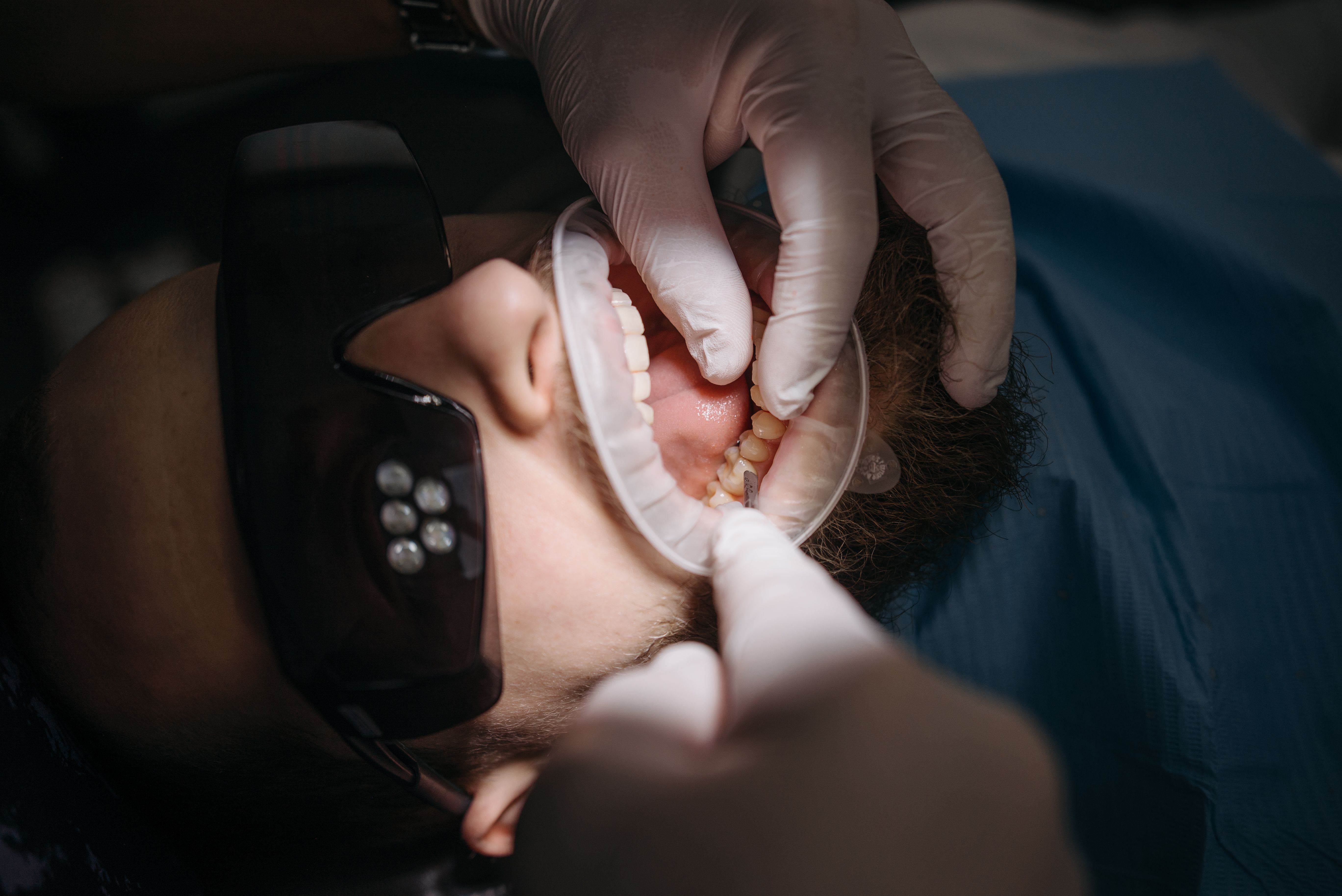 Ribbond and Bio-Core at Stubbs Dental Implant Center