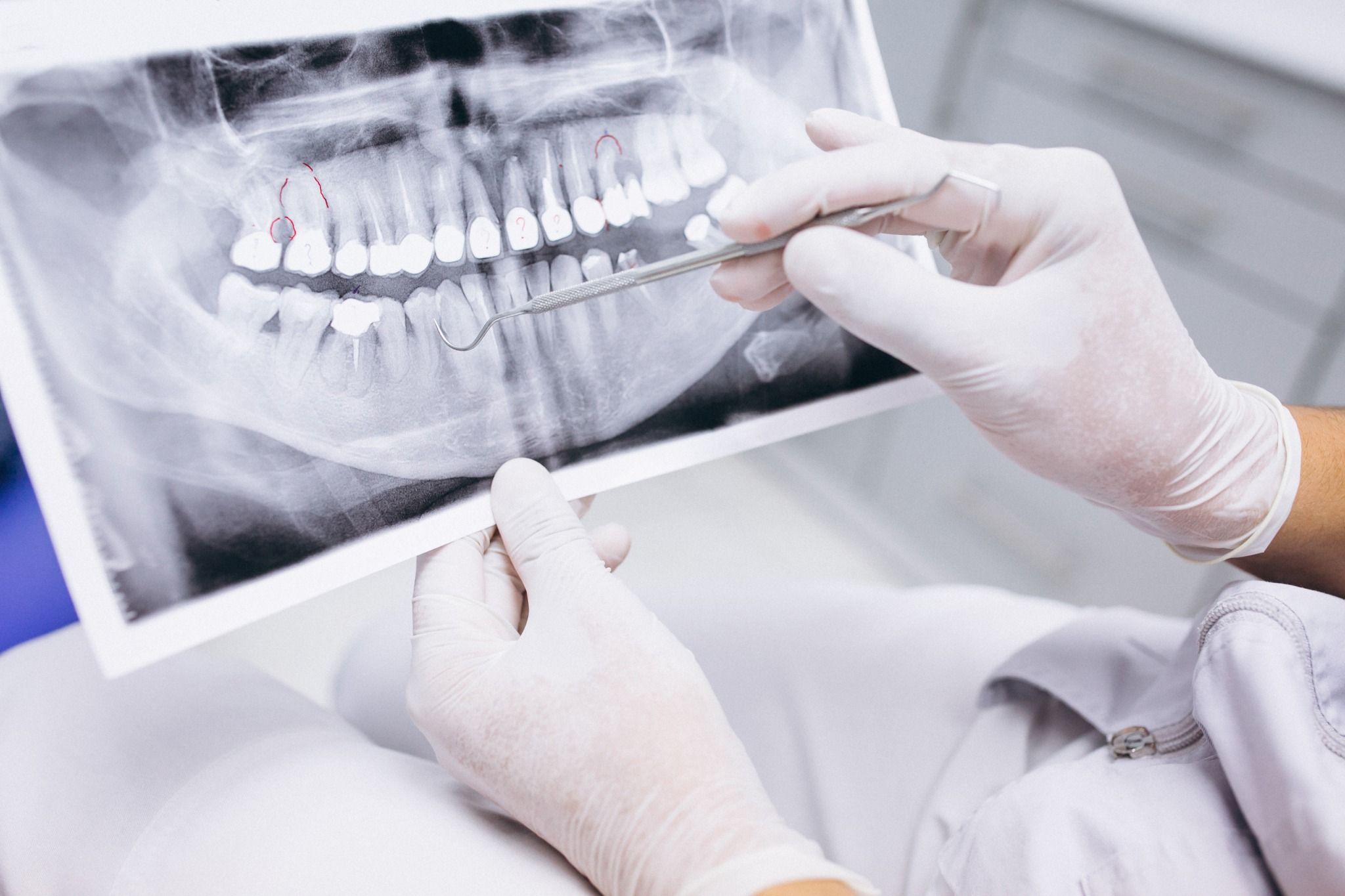 teeth x-ray for oral surgery